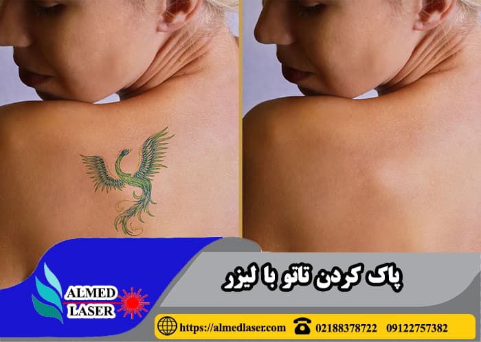 TATOOآریا مد مرجع خرید ، فروش ، تعمیرات و اجاره تجهیزات نو و کارکرده زیبایی